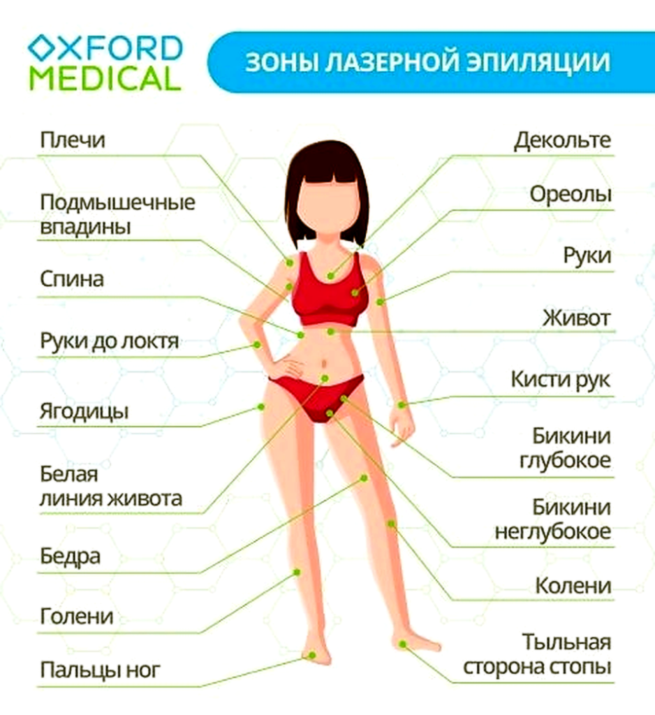 зоны лазерной эпиляции